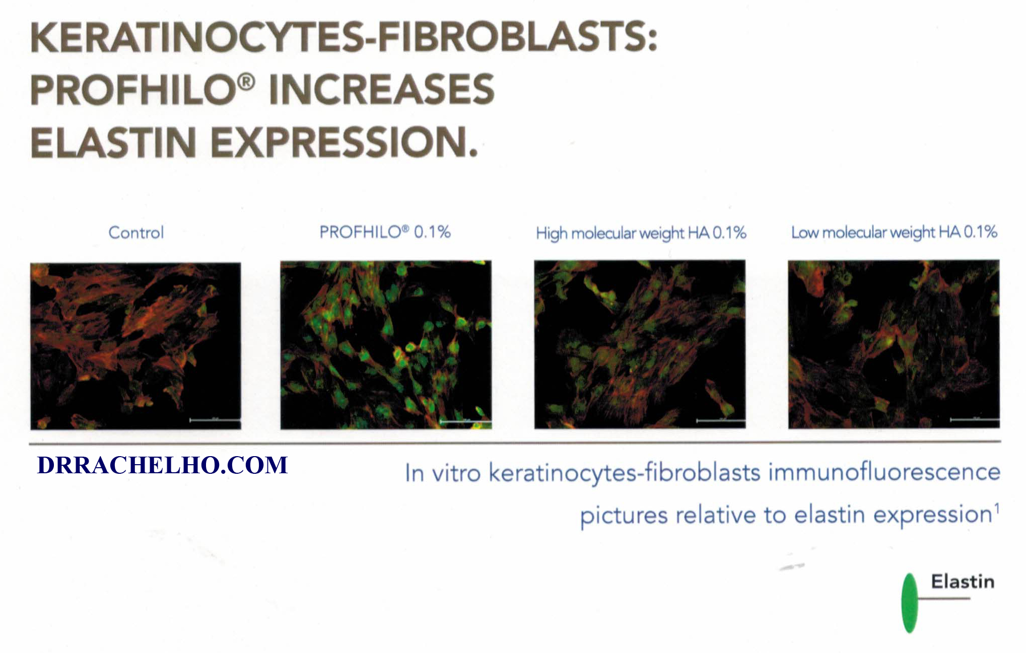 profhilo elastin fibroblasts