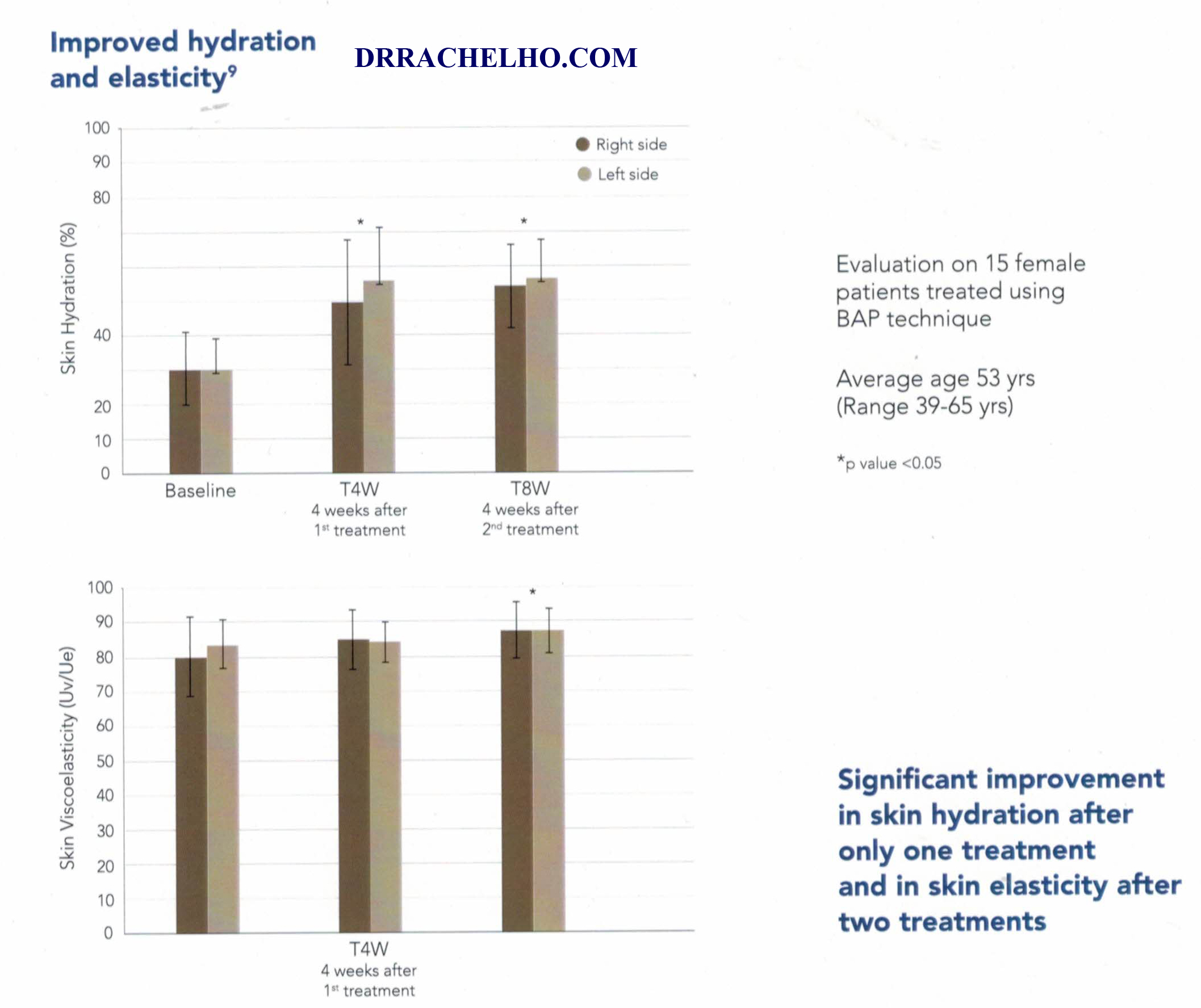 profhilo hydration and elasticity