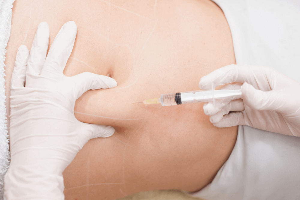 Dr Rachel Ho | Why Are Mesotherapy Fat Dissolving Injections Banned in  Singapore?
