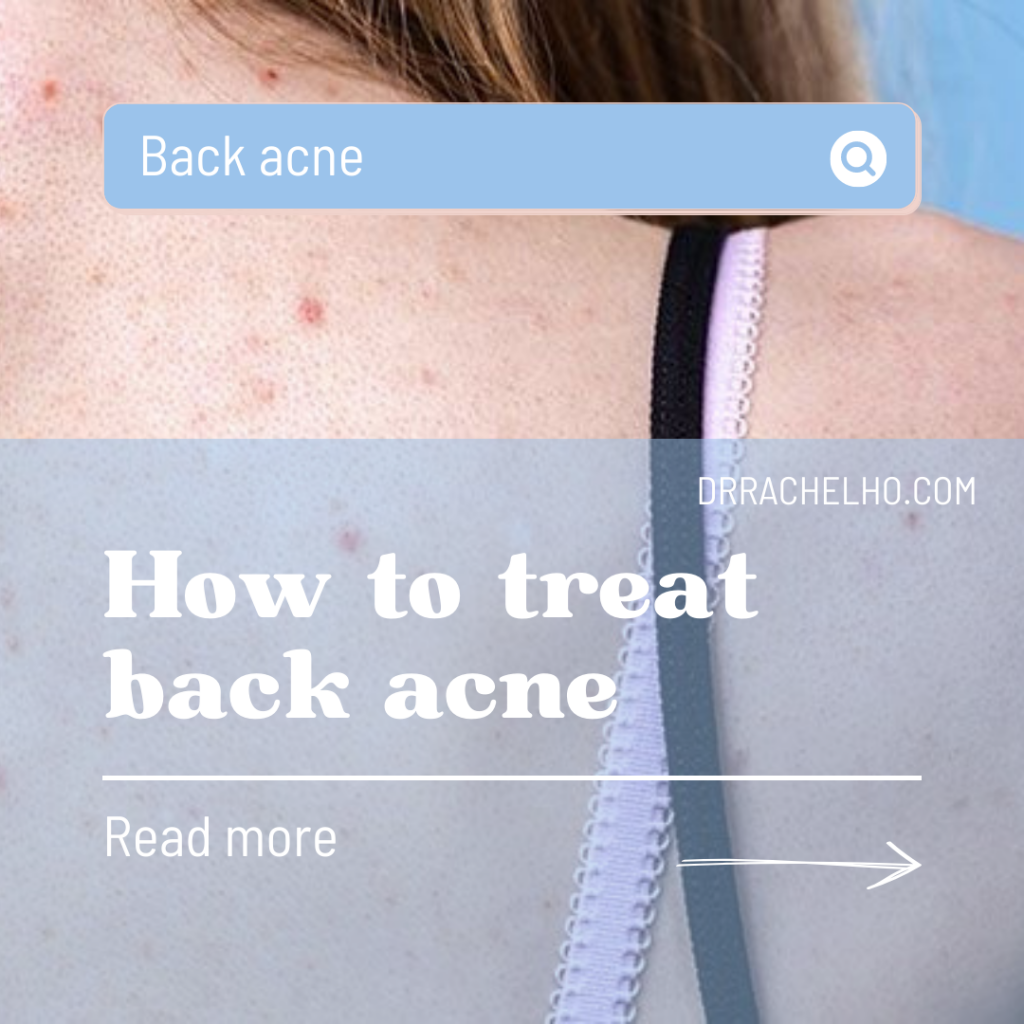Dr Rachel Ho | how to treat back acne