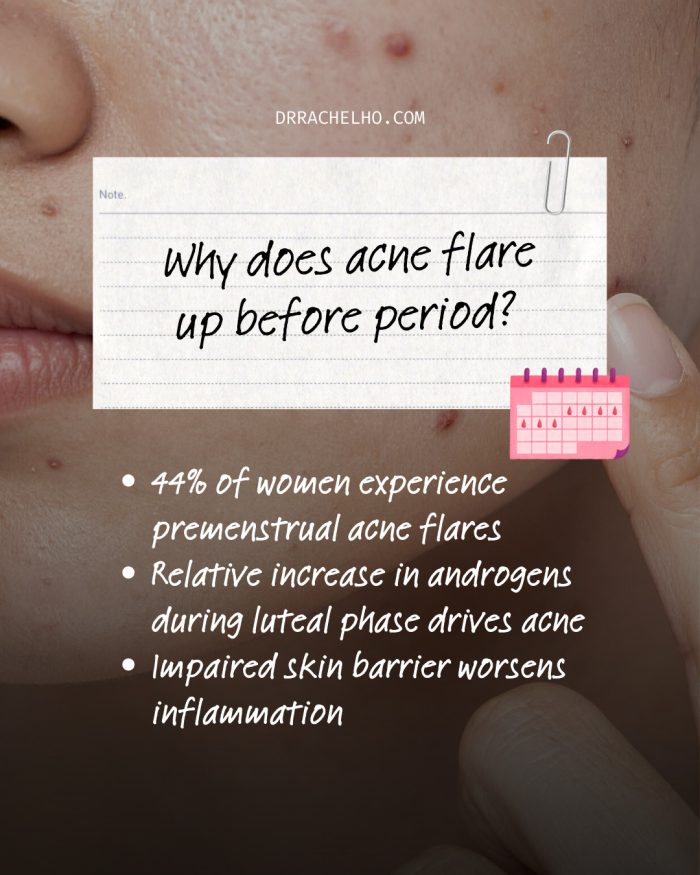 Cycle Sync Skincare for Menstrual Acne - Dr Rachel Ho