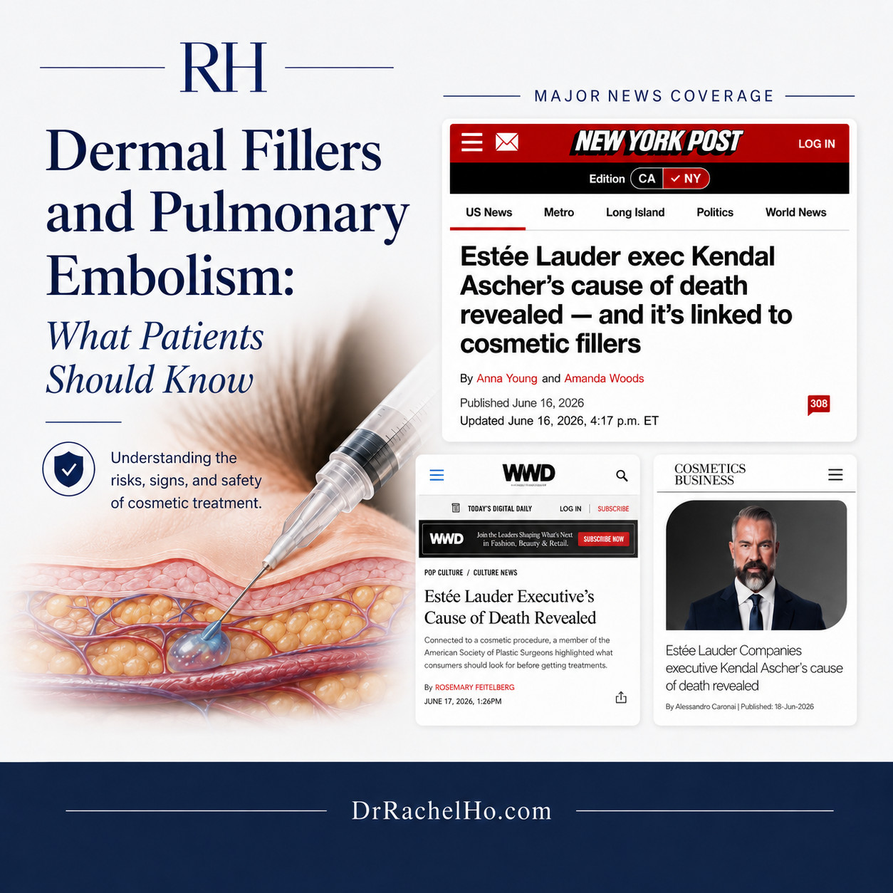 Dermal fillers and pulmonary embolism safety article with major news coverage and filler risk illustration