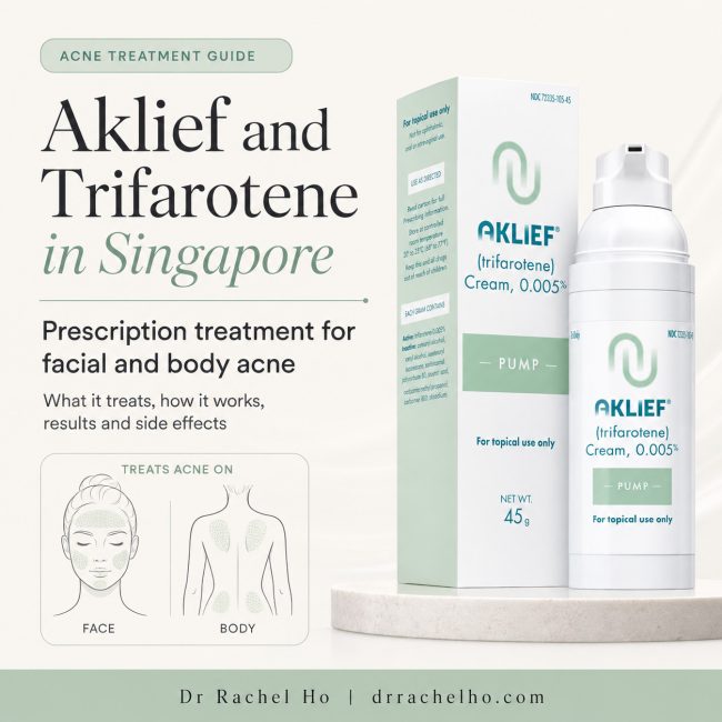 Aklief trifarotene prescription treatment for facial and truncal acne in Singapore, with treatment areas shown on the face and body.
