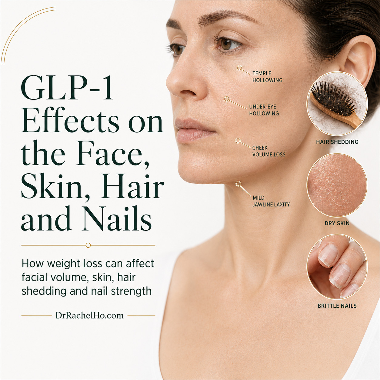 Medical infographic showing facial volume loss, dry skin, hair shedding and brittle nails that may occur during substantial weight loss with GLP-1 medications.