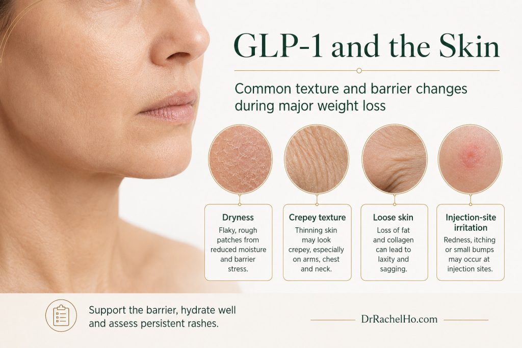 Medical infographic showing dry skin, crepey texture, loose skin and injection-site irritation that may occur during GLP-1 treatment.