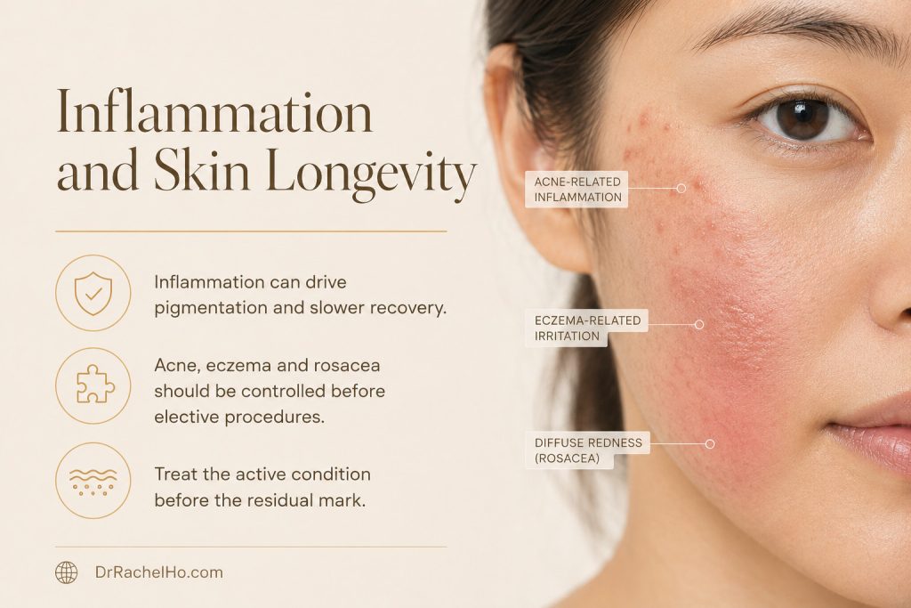 Hyperrealistic Asian skin showing acne-related inflammation, eczema-related irritation and diffuse rosacea redness.