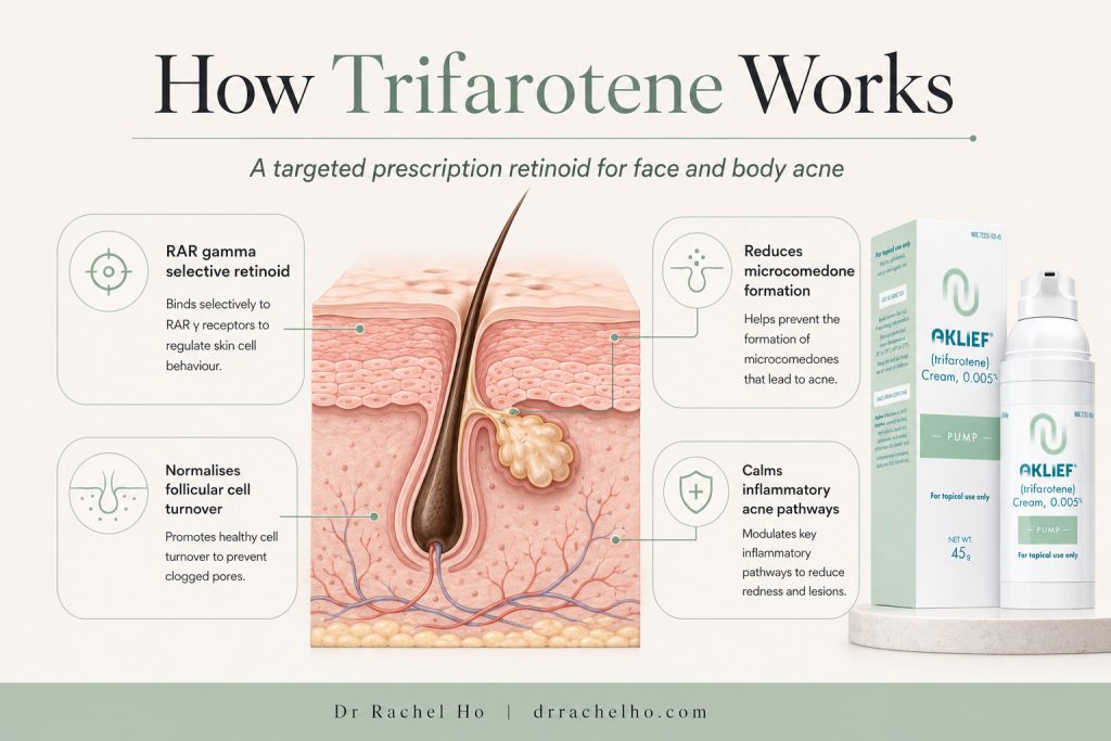 Skin cross-section showing trifarotene selectively activating RAR gamma, reducing microcomedone formation and calming inflammatory acne pathways.