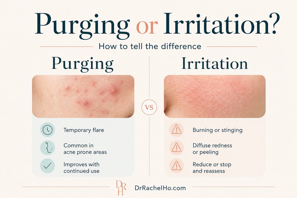 Side-by-side comparison of temporary acne purging and widespread retinoid irritation with redness and peeling.