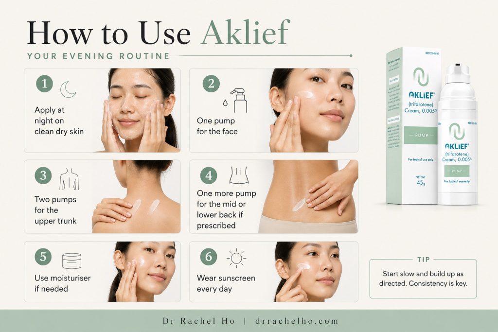 Step-by-step evening application of Aklief trifarotene to the face, upper trunk and back, followed by moisturiser and daily sunscreen.
