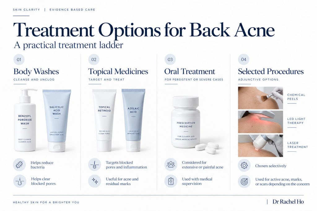 Back acne treatment overview showing body washes, topical medicines, oral treatment and selected clinic procedures.