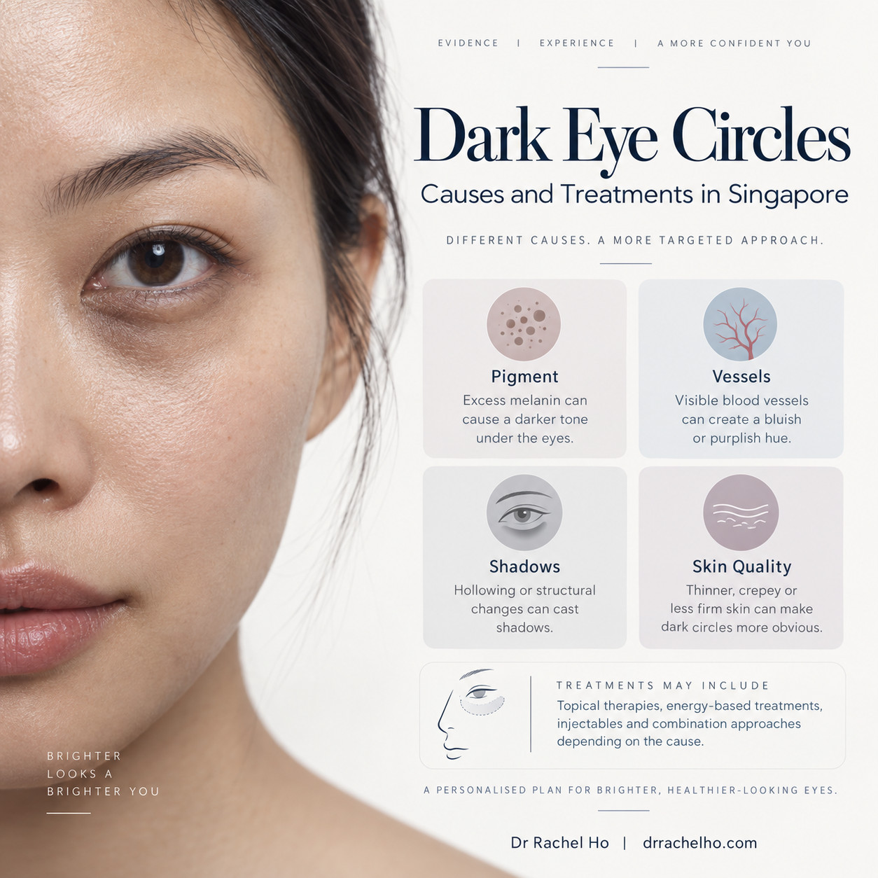 Dark eye circles guide by Dr Rachel Ho, showing an under eye close up and pigment, vessels, shadows and skin quality.