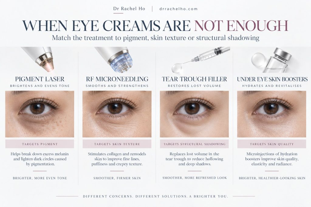 Graphic comparing pigment laser, RF microneedling, tear trough filler and skin boosters for different under eye concerns.