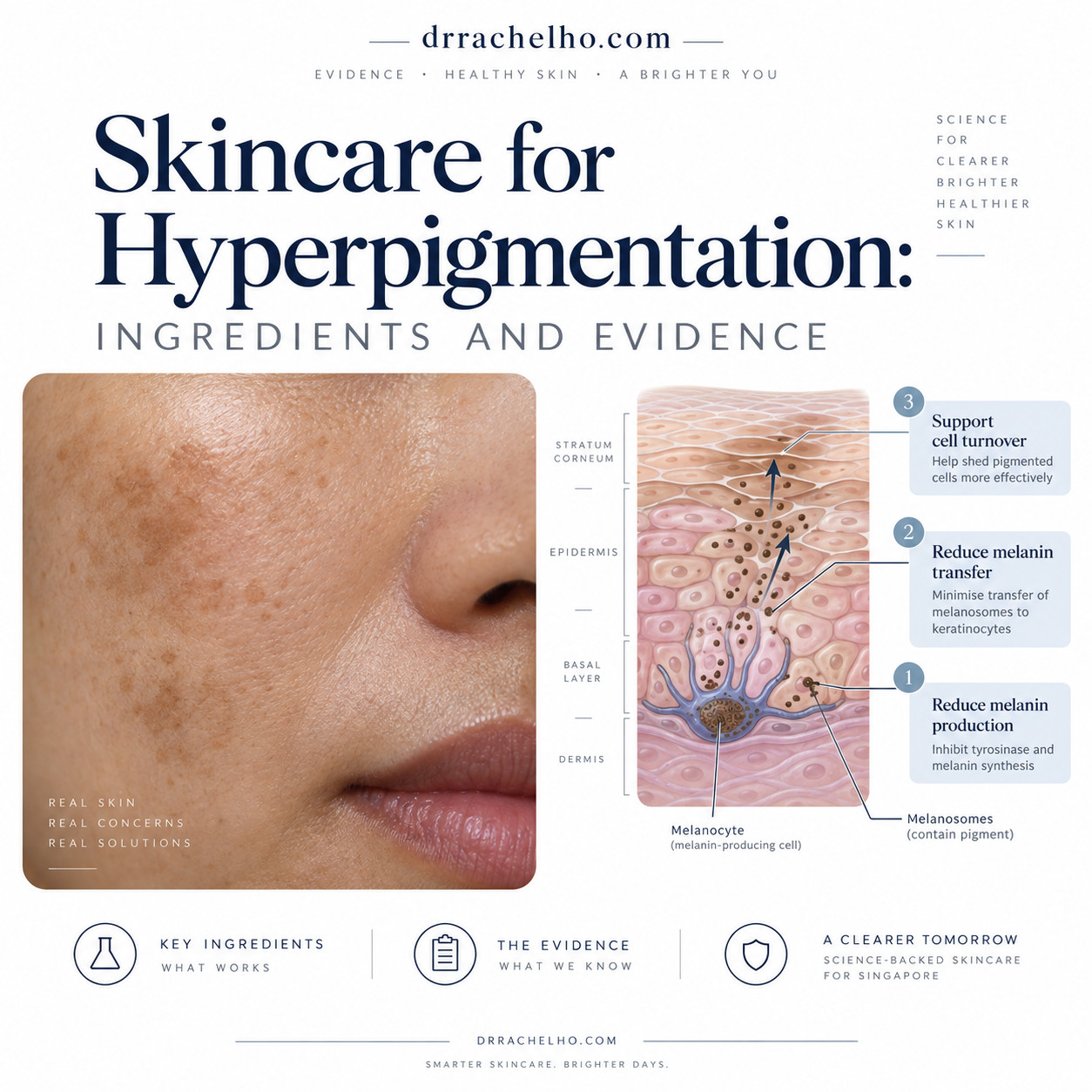 Illustrated cheek with dark spots beside a skin diagram showing melanin production, pigment transfer and cell turnover.