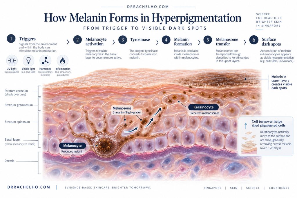 Skin cross section showing melanocytes, melanosomes and pigment transfer to keratinocytes, with common pigmentation triggers.
