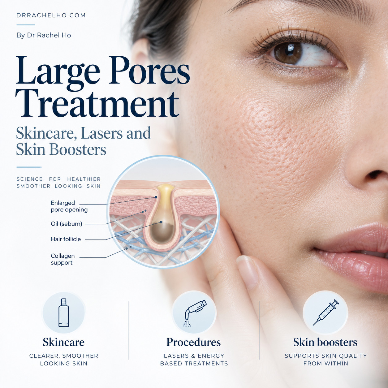 Large pores treatment cover showing a close up cheek with visible pores and a skin diagram of an enlarged pore with sebum and collagen support.