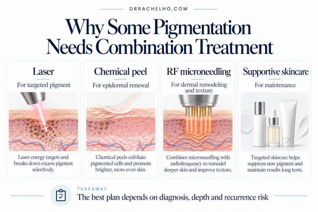 Infographic showing combination treatment for pigmentation using laser, chemical peel, RF microneedling and supportive skincare