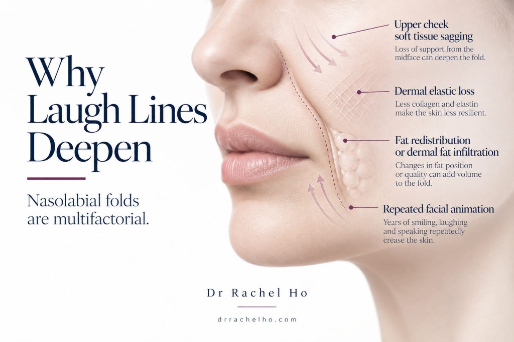 Facial illustration showing cheek sagging, reduced skin elasticity, fat changes and movement around a nasolabial fold.
