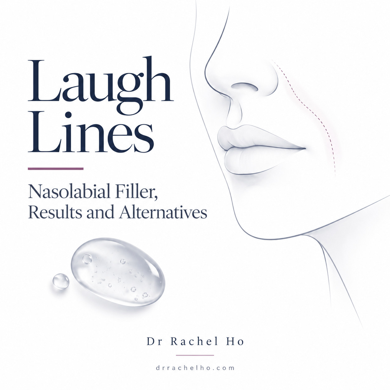 Illustrated lower face with a nasolabial fold outline and gel droplet introducing Dr Rachel Ho’s laugh line review.