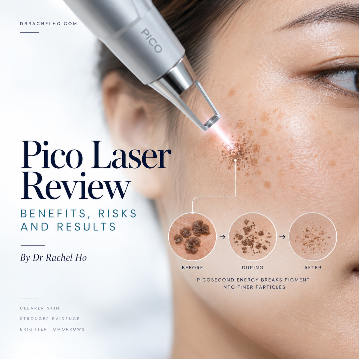 Pico Laser Review cover with an illustrated laser treatment on pigmented cheek skin and a pigment fragmentation sequence.