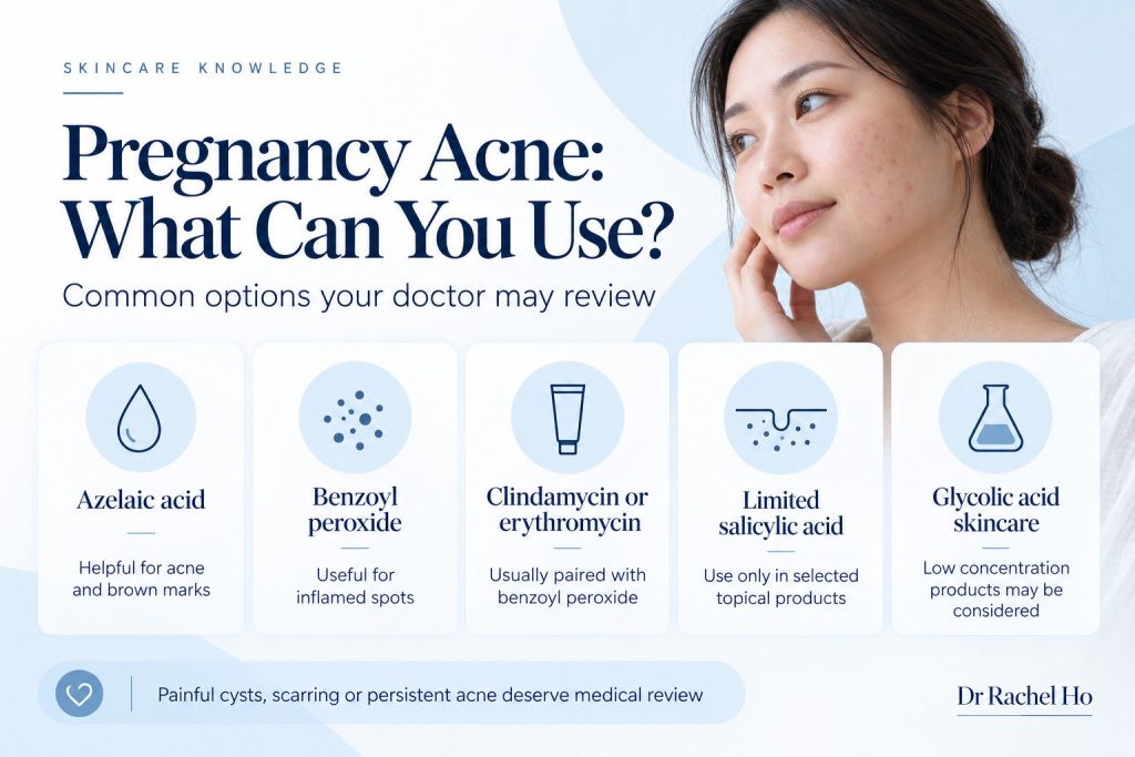 Pregnancy acne options including azelaic acid, benzoyl peroxide, prescription topical antibiotics and selected exfoliating acids.