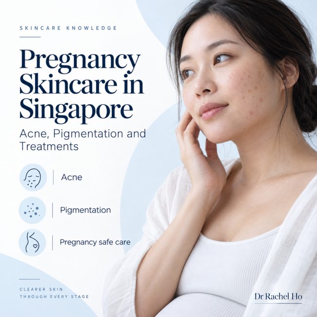 Pregnancy skincare guide for Singapore, with a woman touching her cheek beside information on acne, pigmentation and treatment choices.