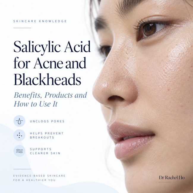 Salicylic acid for acne and blackheads guide beside a close view of a woman’s nose and cheek.