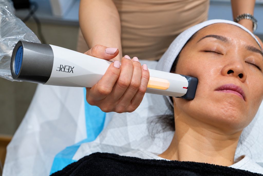 XERF effector on a patient's face